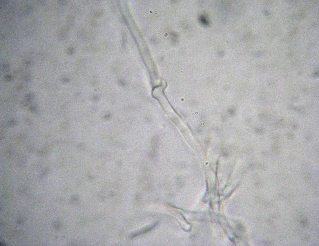 Steccherinum?
